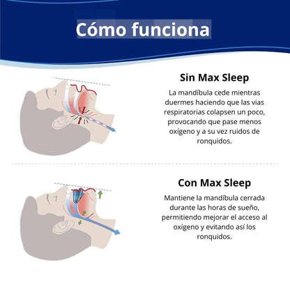 Bucal anti ronquidos Max Sleep