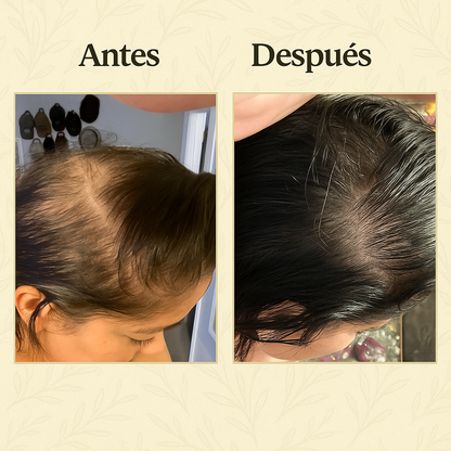 Veganic - Aceite Natural Para el Crecimiento del Cabello